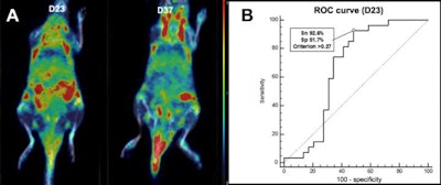 On day 23 and day 37, increased uptake (A) is noted in the front and hind paws of this mouse with collagen-induced arthritis. Graph shows predictive performance (B) of F-18 FEDAC uptake on day 23 for the development of clinical arthritis. ROC = receiver operating characteristic; Sn = sensitivity; Sp = specificity. Images courtesy of Seoul National University and Ewha Womans University.
