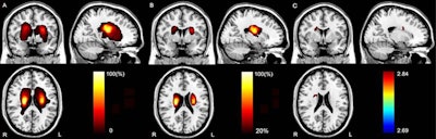 2018 05 08 22 51 3874 2018 05 09 Mri Stroke Attention 20180508224523