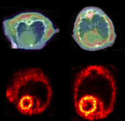 PET imaging with Amyvid showed amyloid accumulation in mice with heart failure (right) versus healthy controls (left). Image courtesy of Circulation Research.