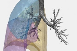2018 05 14 17 15 9404 Ct Lung Structure 20180514171242