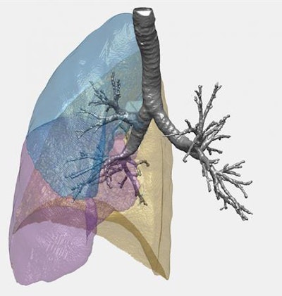 Illustration of lung structure based on the topology of CT scans. Image courtesy of the University of Southampton.