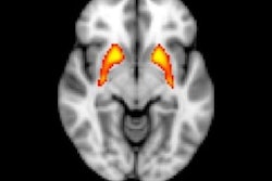 2018 05 16 23 36 2584 F Mri Psychosis Kerns 400