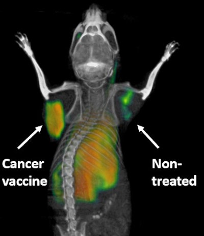 PET scanning technique highlights activated immune cells fighting cancer in a mouse in real-time. The tumor that received a direct injection of the cancer vaccine lights up, whereas the nontreated tumor is quiet. Courtesy of Dr. Sanjiv Gambhir, PhD.