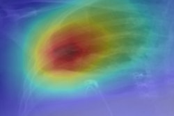 2018 05 17 21 45 6450 Effusion 20180517212616