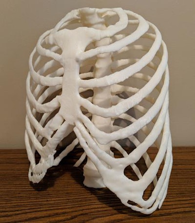 A 3D-printed rib cage. All images courtesy of Dr. Jorge Zuniga and Trevor Huff.