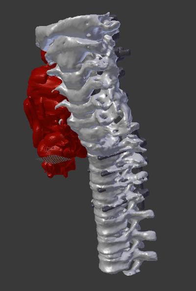 3D model of the spine.