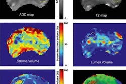 2018 05 23 23 08 1123 Oto Cancer Volume Images 20180523231144