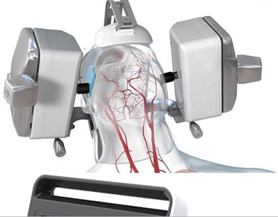 Lucid robotic ultrasound machine. Image courtesy of Neural Analytics.