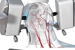 2018 06 01 21 13 2159 Robotic Ultrasound 20180601215744