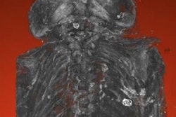 2018 06 01 22 36 7839 Micro Ct Fetus 20180601220419