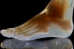2018 06 01 23 10 4860 3 D Printed Foot 400