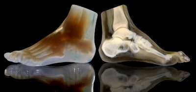 3D-printed foot (left) and corresponding cross section (right) reveal the internal structure of the foot bones and surrounding soft tissue. Image courtesy of Steven Keating, PhD, from Harvard University and Ahmed Hosny, PhD, from the Dana-Farber Cancer Institute.