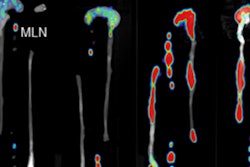 2018 06 04 20 34 2873 Jnm Immuno Pet Friese 20180604203112