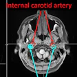 2018 06 05 23 12 7618 Purdue Mri 20180605232602