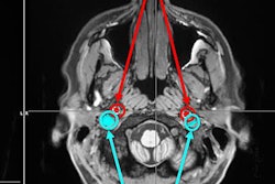 2018 06 05 23 12 7618 Purdue Mri 20180605232602