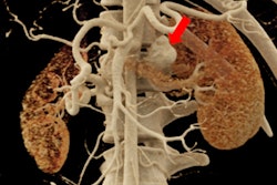 2018 06 12 21 36 2187 Cr Stomach Kidney 400