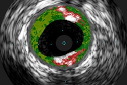 2018 06 14 21 32 9543 Alpha Gal Ige 400