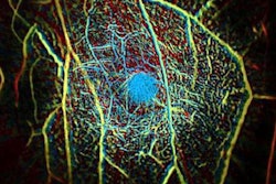 2018 06 18 20 05 8690 Breast Vascular Tissue 20180618203932