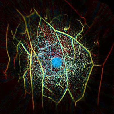 A false-color image that shows the vascular structure of a healthy human breast. Image courtesy of the California Institute of Technology.