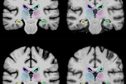 2018 06 19 22 17 2727 Brain Mri Registration 20180619221642