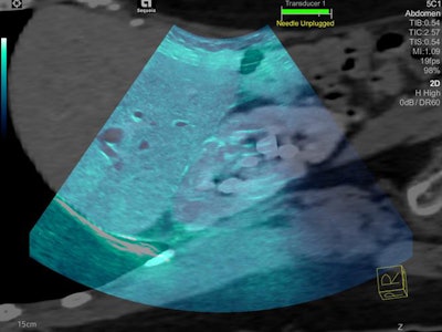 Bioacoustic imaging technology preserves the acoustic fidelity of the B-mode ultrasound signal and adapts to variations in each patient.