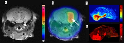 (A) Representative contrast-enhanced T2-weighted MR coronal image of AAV-transduced mouse brain. (B) Corresponding merged F-18 DASA-23 PET/MR images (10 to 30 minutes summed F-18 DASA-23 activity). The white arrow indicates regions of radiotracer uptake corresponding to the transduced region. (C) Autoradiography of mouse brain sections excised one hour after radiotracer administration and (D) an immunofluorescence stain for PKM2. Image courtesy of Thomas Haywood, PhD, et al and Stanford University School of Medicine.