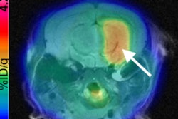 2018 06 25 20 54 6996 Haywood Gambhir Figure 400