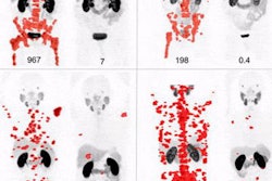 2018 06 26 22 57 6437 2018 06 26 Snmmi Image Of The Year 20180626220706