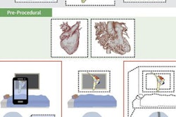 2018 06 27 21 09 7644 Mixed Reality Cardiac Electrophysiology 20180627212952