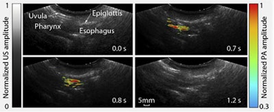 Images show roasted barley as a subject swallows it over the course of 1.2 seconds. Courtesy of the University of New York at Buffalo.