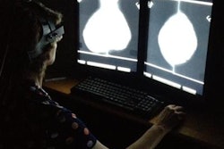 2018 06 28 23 00 7380 Ai Mammogram Ornl 20180628233242