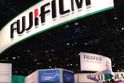 2018 03 07 19 36 1400 Fujifilm 2017 Rsna 400