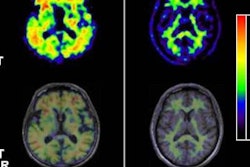 2018 07 02 17 03 9361 Piramal Thumbnail 400