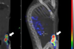 2018 07 02 21 04 7999 Jnm Mice Nano Spect Ct Image 215