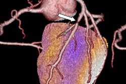 2018 07 03 16 22 0383 Cardiac Hybrid Image 20180703164402