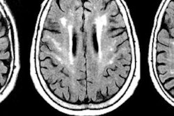 2018 07 03 17 17 9920 White Matter Johns Hopkins 400