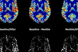 2018 07 05 17 31 7148 Necktie Mri 20180705174812
