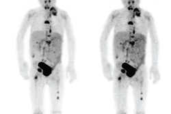 2018 07 06 22 01 6839 Snmmi Tof Petmri 20180706225233