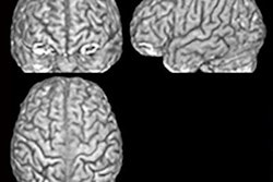 2018 07 10 22 42 5966 Lutz Jaencke Mri Brain Anatomy 400