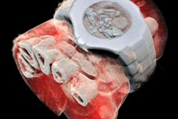 2018 07 17 18 52 3838 Spectral Ct 20180717180724