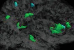 2018 07 31 16 51 3926 2018 07 31 Dti Mri Soccer Heading 20180731161152