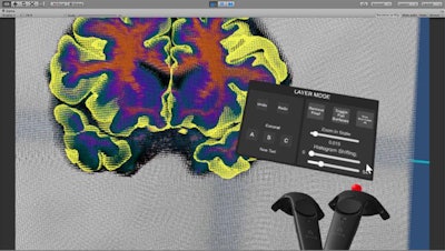 The Virtual Brain Segmenter interface. Image courtesy of Dominique Duncan, PhD.