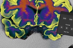2018 08 01 18 33 6291 2018 07 26 Vr Virtual Brain Segmenter 20180801181159