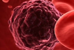 2017 09 14 23 05 1167 Cancer Cell 400