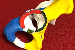2018 08 06 18 01 4460 3 D Printing Fracture 20180806180708