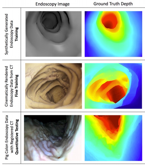 Cinematic rendering bolsters AI for depth estimation on endoscopy ...