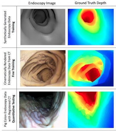 Synthetically generated endoscopy images (top), cinematically rendered CT scans (middle), and real endoscopy images (bottom). Image courtesy of Dr. Faisal Mahmood and Dr. Nicholas Durr.
