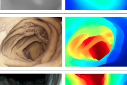 2018 08 21 16 40 1777 Cinematic Rendering Colon 20180821163313