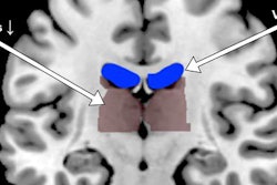 2018 08 22 20 50 5903 F Mri Dehydration 20180822200717