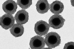 2018 08 24 21 13 0288 Iron Mri Contrast 400